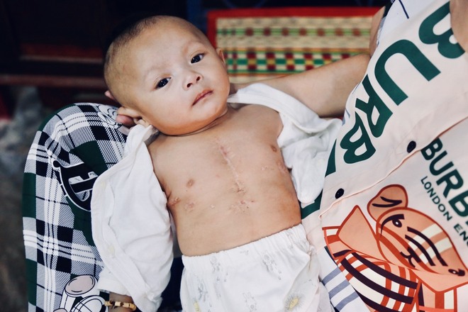 Xót cảnh bé trai 4 tháng tuổi bị bệnh tim bẩm sinh, cha mẹ nghèo bật khóc xin giúp đỡ-3