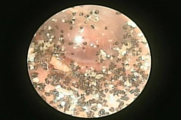 Bé trai bị xích xe máy nghiến đứt lìa bàn tay-2