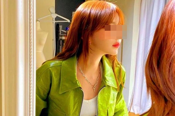 6 thay đổi lớn về ngoại hình đang cố lật tẩy” bệnh tuyến giáp nhưng dễ bị làm ngơ-1