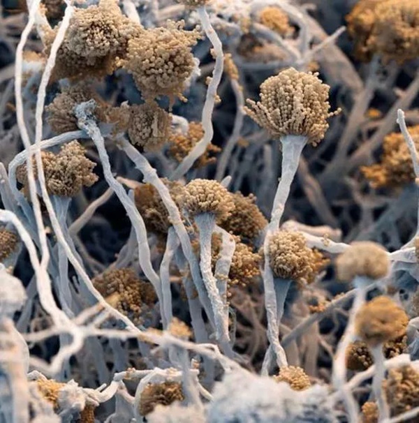 WHO cảnh báo chất độc gây ung thư rất mạnh, trú ngụ ở 2 món đồ và 3 món ăn quen thuộc trong nhà mà ít người để ý-2