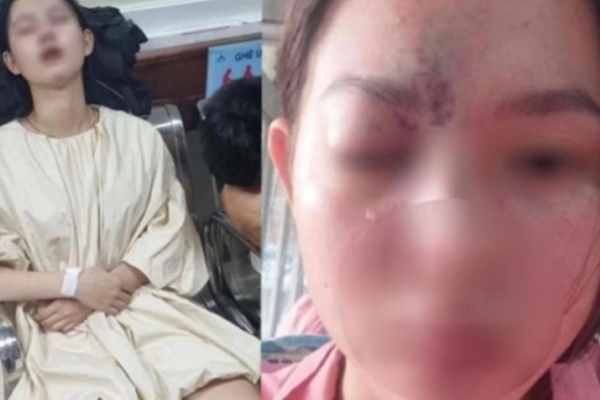 Tử vong sau nâng mũi: Yêu cầu phòng khám Thailand Hospital tạm ngưng dịch vụ-2