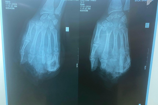 Người đàn ông gây tai nạn liên hoàn khiến 3 người tử vong-2