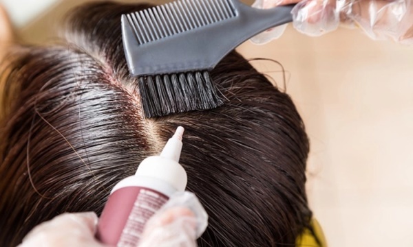 Người phụ nữ hôn mê sau 4 giờ nhuộm tóc và suýt mất mạng, bác sĩ nhắc nhở đối tượng nên cảnh giác khi làm đẹp-2