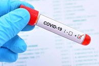 Biến thể Covid-19 khiến nhiều người tử vong ở Thái Lan đã xuất hiện tại TP.HCM