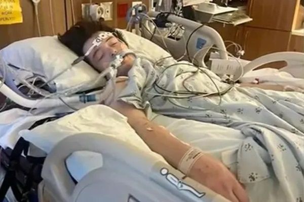 Chàng trai 22 tuổi chỉ có 1% cơ hội sống, buộc phải ghép cả 2 lá phổi vì sở thích này của nhiều người-2