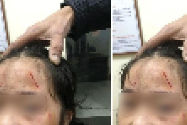 Kỷ luật kế toán vì ‘quên’ nộp tiền bảo hiểm y tế của 232 học sinh-2