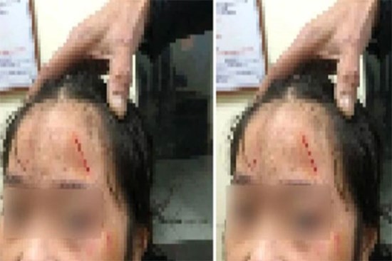 Vụ nữ sinh lớp 6 bị bạn bạo hành