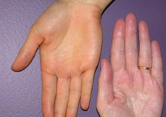 Bàn tay có thể nói lên tuổi thọ của một người, sống lâu ắt sẽ xuất hiện 6 điểm đặc biệt-1