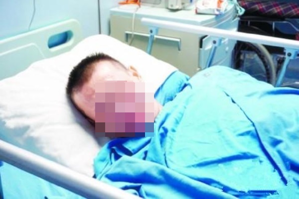 Người đàn ông bỗng mắc ung thư dạ dày, bác sĩ cảnh báo 2 loại khoai cực độc cần tránh xa-1