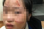 Thiếu nữ bị đánh hội đồng, lột áo trong đêm ở Đắk Lắk: Kỷ luật hai học sinh-2