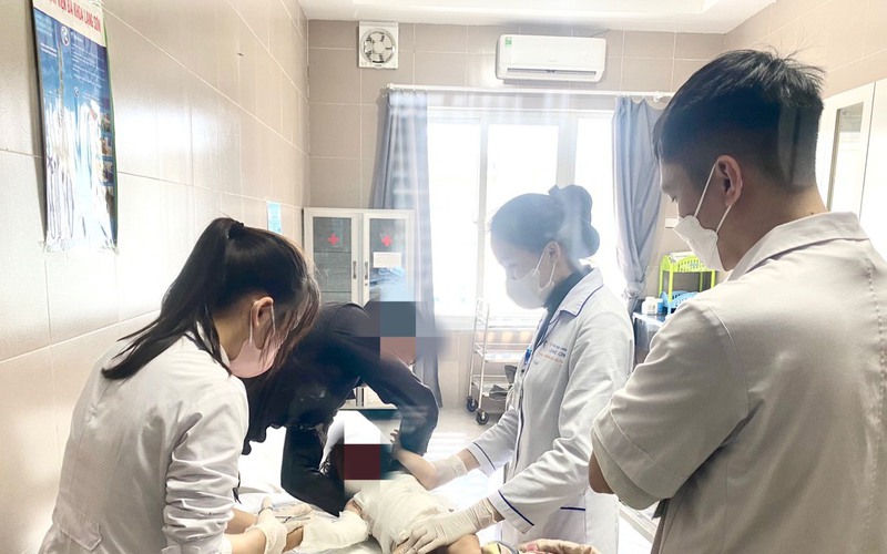 2 trẻ bị bỏng nặng do sự bất cẩn của người lớn-1