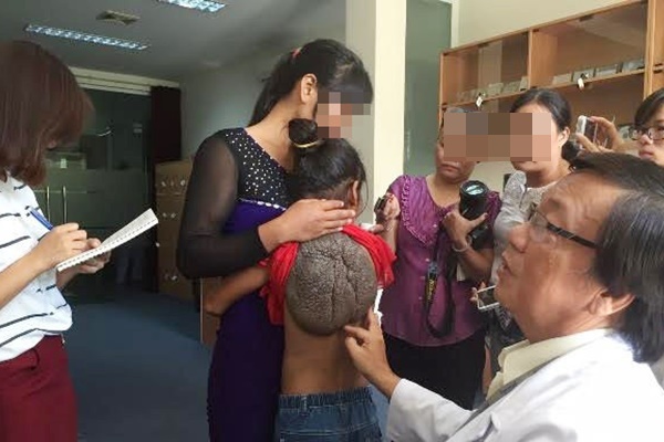 Căn bệnh hiếm gặp, thế giới có vài ca gồm một người Việt Nam-1