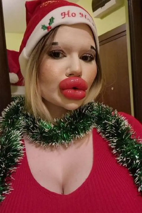 Cô gái có đôi môi lớn nhất thế giới muốn bán đấu giá những nụ hôn-2