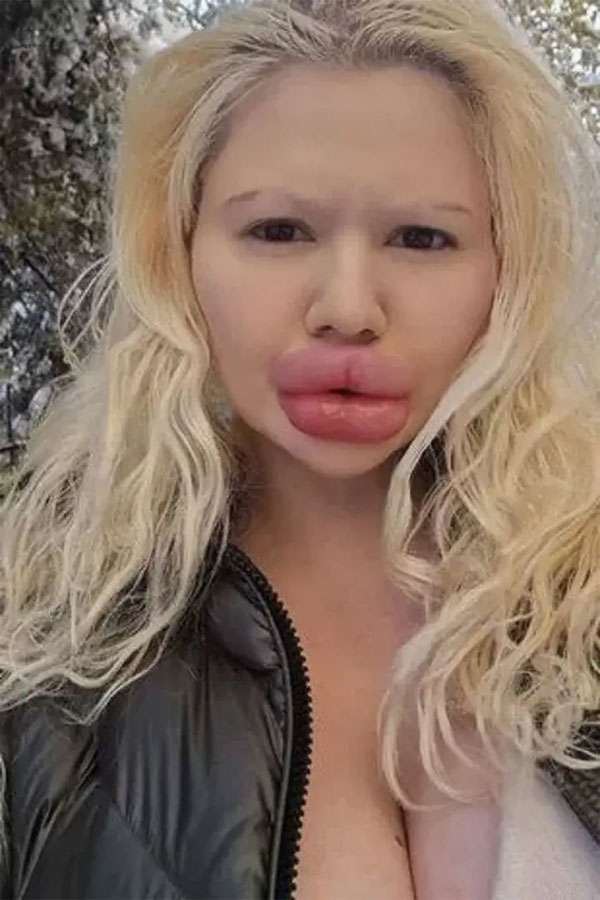 Cô gái có đôi môi lớn nhất thế giới muốn bán đấu giá những nụ hôn-3