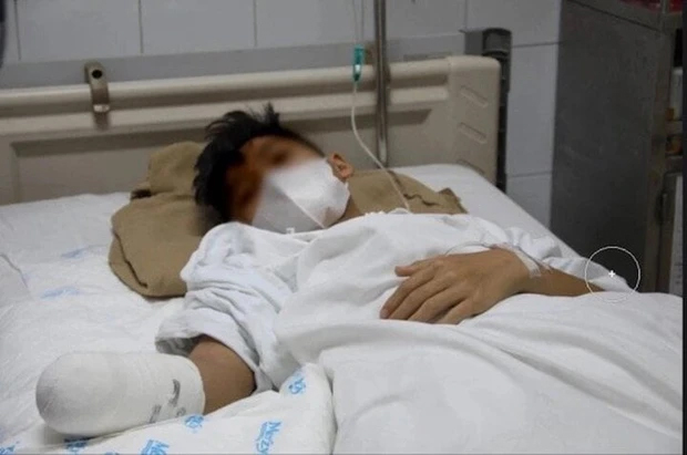 Nghịch pháo ngày Tết, thiếu niên mất bàn tay phải-1