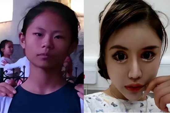 Cô gái nghiện làm đẹp từ năm 13 tuổi, chi 14 tỷ đồng để phẫu thuật thẩm mỹ, hiện tại hối hận nhưng đã muộn màng