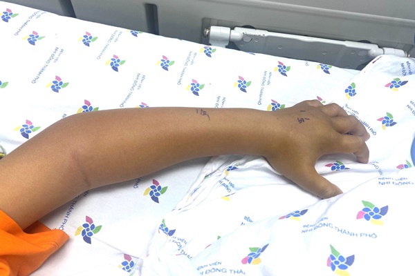 Nhập viện khẩn chiều mùng 1 Tết vì tai nạn xảy ra khi đánh răng-1