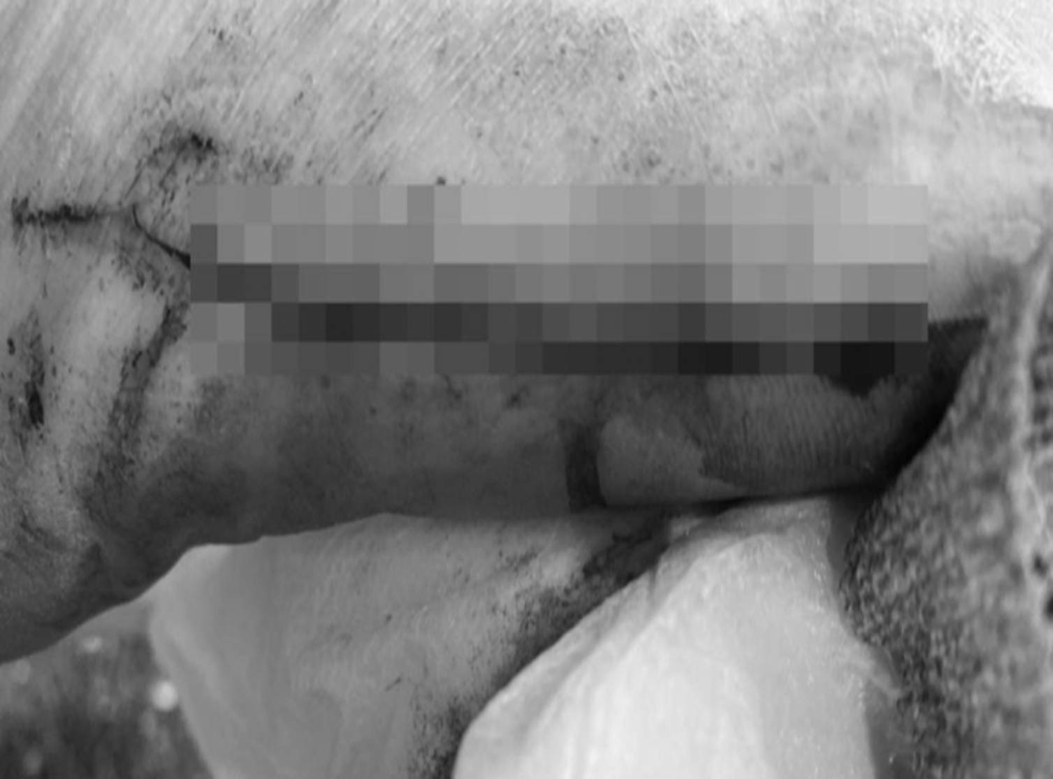 Mua giày giá rẻ trên sàn thương mại điện tử nổi tiếng, người phụ nữ mất 50 triệu VNĐ điều trị vết thương còn mang sẹo ám ảnh cả đời-2