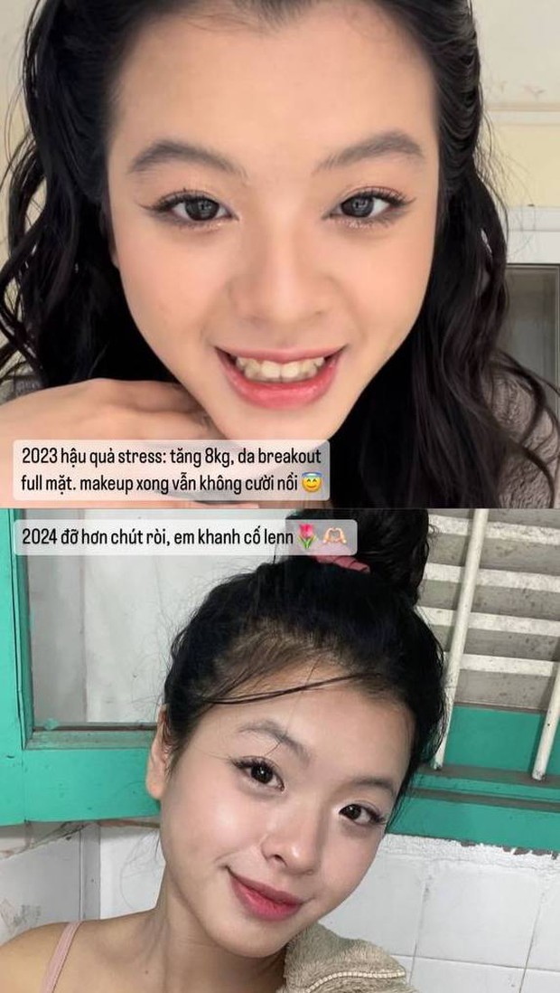 Tiểu thư nhà NSƯT Chiều Xuân tâm sự về khủng hoảng tăng 8kg và da nổi chi chít mụn-3