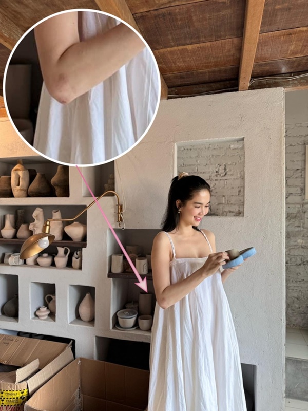 Ngọc Trinh zoom cận tình trạng những vết thương sau 4 tháng gặp tai nạn lái xe mô tô-2