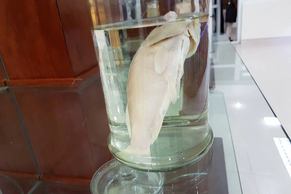 Tưởng ung thư vì sụt cân, chán ăn, ngỡ ngàng thấy con ngọ nguậy trong gan-1