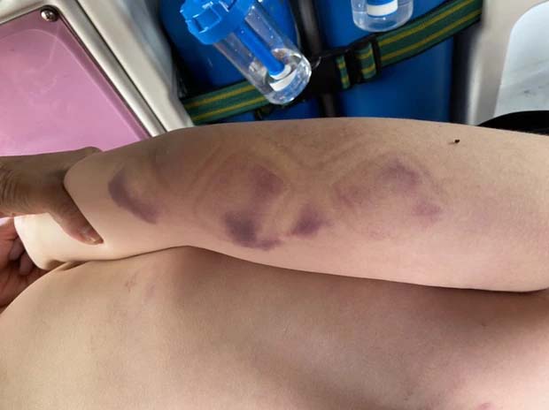 Phục hồi điều tra vụ án bé trai người Nhật đuối nước tại Phan Thiết-2