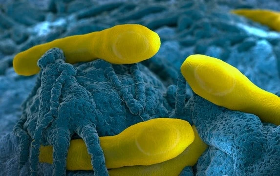 Hai ca nghi nhiễm chất cực độc ở TP.HCM ăn gì trước khi nhập viện?-1