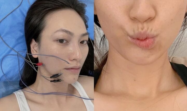 Nữ chính phim ‘Mai’ từng muốn bỏ nghề vì méo khung môi sau khi mắc bệnh nặng-2