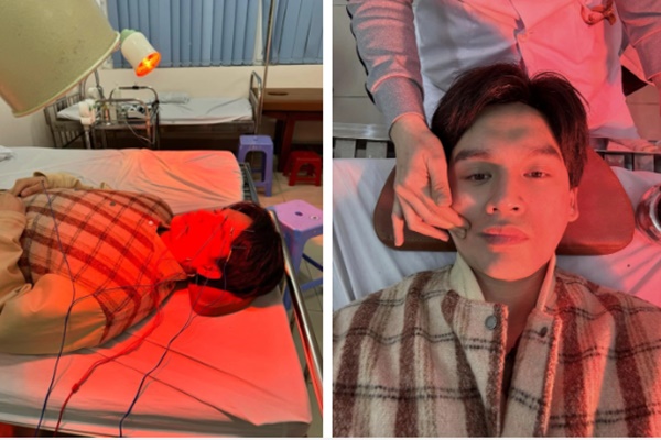 Nam ca sĩ liệt nửa mặt ngay trong buổi biểu diễn: Đâu là nguyên nhân?-1