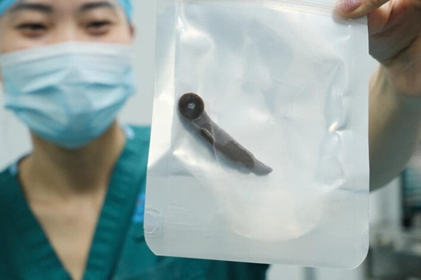 Mẹ day dứt vì gần 10 năm chạy chữa mới biết con bị bệnh hiếm-3