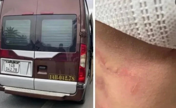 Khách tố bị nhà xe ở Quảng Ninh hành hung, bỏ giữa cao tốc: Tài xế khai gì?-1