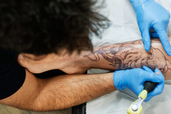 Cà Mau hỏa tốc chỉ đạo phòng, chống sau ca nghi ngờ mắc bệnh đậu mùa khỉ-2