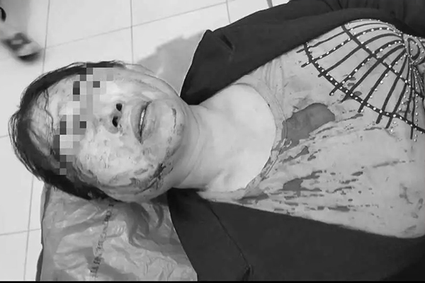 Công an vào cuộc vụ người vợ bị chồng bạo hành nhập viện trước ngày ly hôn-4