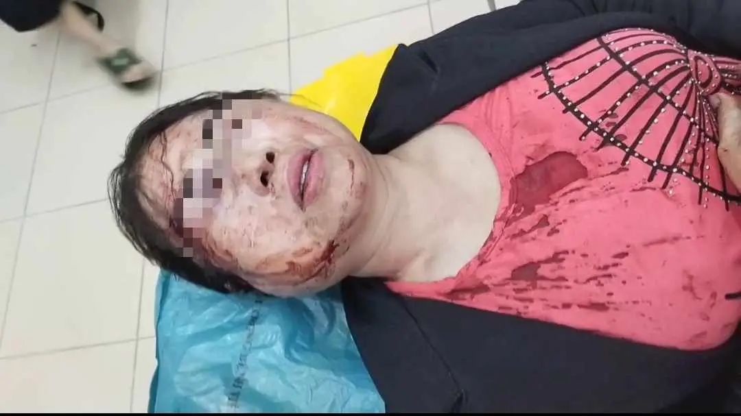 Chồng đánh vợ nhập viện trước ngày ra tòa ly hôn: Thông tin mới nhất-1