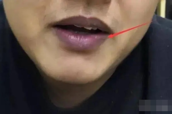 Thận không tốt, cơ thể sẽ xuất hiện hai đen một hôi”, làm sớm 4 điều này để không hối hận-1