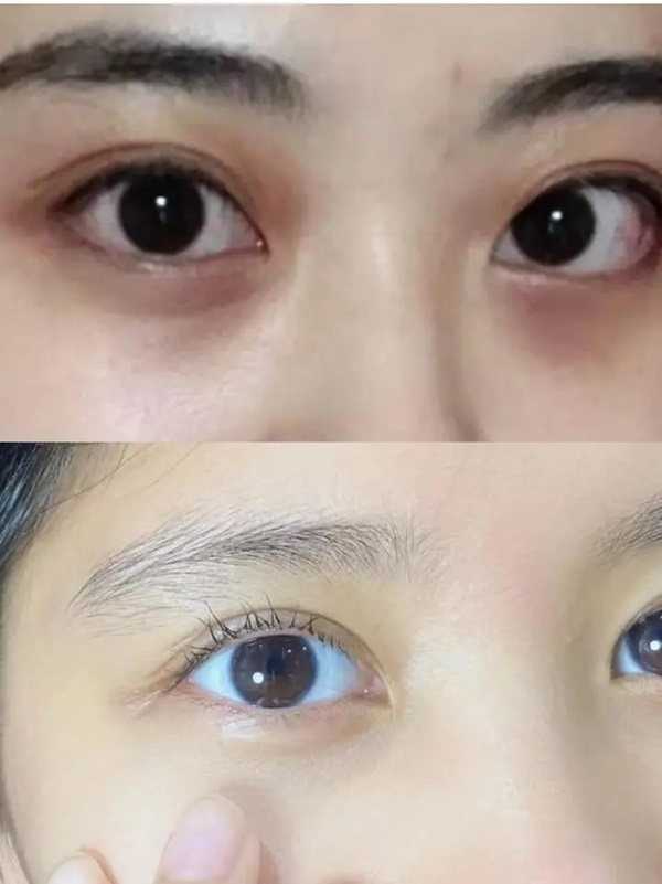 Thận không tốt, cơ thể sẽ xuất hiện hai đen một hôi”, làm sớm 4 điều này để không hối hận-2