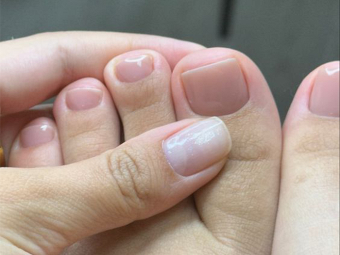 Người may mắn sở hữu thận khỏe sẽ có 3 điểm này trên bàn chân, hãy tự kiểm tra-2