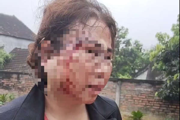 Chồng quyết ly hôn, tòa bảo không-2