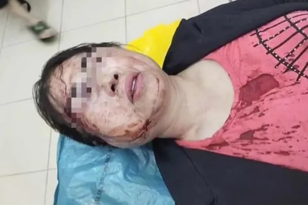 Công an vào cuộc vụ người vợ bị chồng bạo hành nhập viện trước ngày ly hôn-2