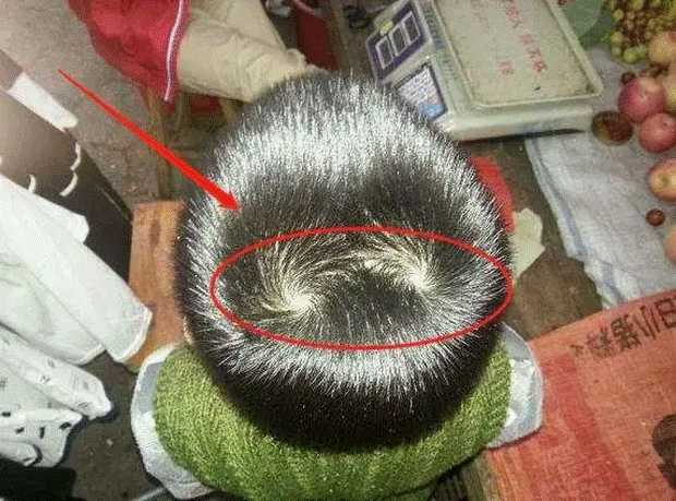 Thấy con có 2 xoáy tóc trên đầu, nhiều bố mẹ vui mừng tột độ: Sự thật đằng sau lại gây hụt hẫng-1