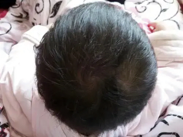 Thấy con có 2 xoáy tóc trên đầu, nhiều bố mẹ vui mừng tột độ: Sự thật đằng sau lại gây hụt hẫng-2