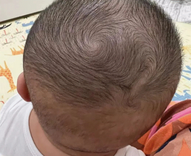Thấy con có 2 xoáy tóc trên đầu, nhiều bố mẹ vui mừng tột độ: Sự thật đằng sau lại gây hụt hẫng-3