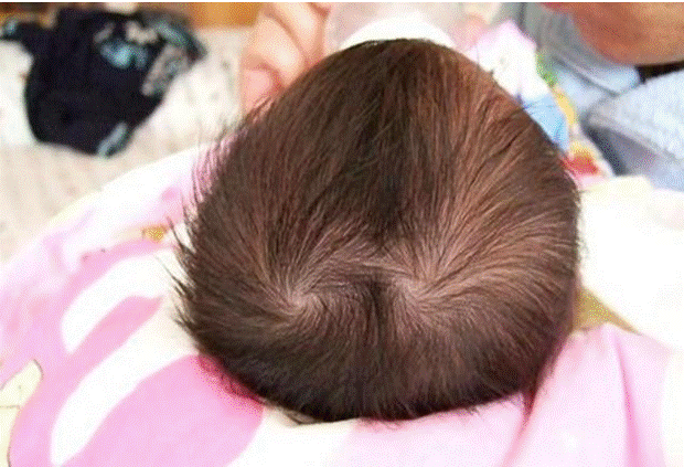 Thấy con có 2 xoáy tóc trên đầu, nhiều bố mẹ vui mừng tột độ: Sự thật đằng sau lại gây hụt hẫng-4
