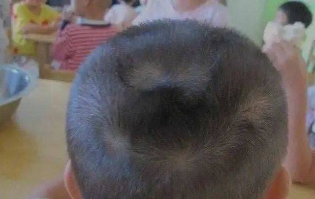 Thấy con có 2 xoáy tóc trên đầu, nhiều bố mẹ vui mừng tột độ: Sự thật đằng sau lại gây hụt hẫng-5