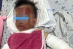 Laptop phát nổ - bé trai nhập viện trong tình trạng sốc đa chấn thương-4