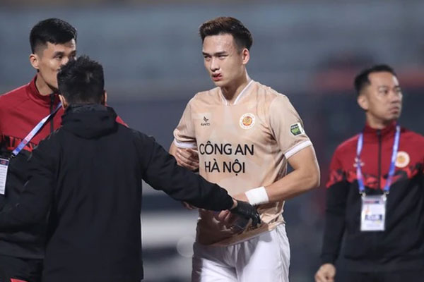 Bùi Hoàng Việt Anh dính chấn thương đáng sợ, phải khâu 24 mũi-1