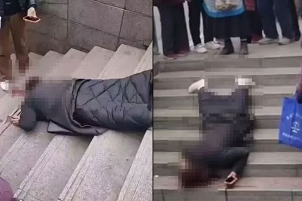 Vừa xuống cầu thang vừa dùng điện thoại, cô gái ngã rách đầu, hôn mê-1