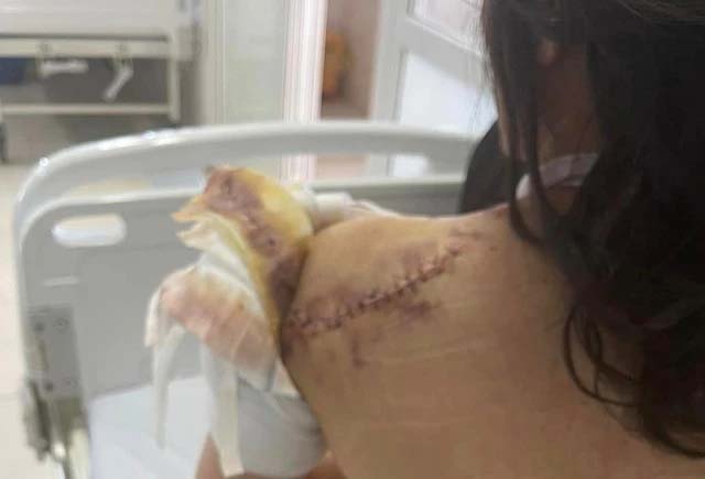 Bắt được đối tượng vụ 1 phụ nữ cầu cứu vì 2 lần bị truy sát-1