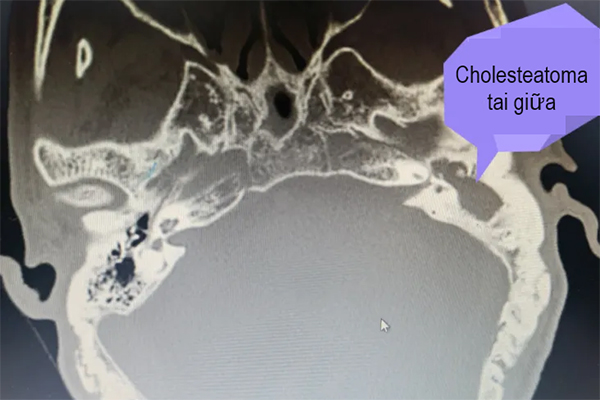 Nam thanh niên ở Quảng Bình nghi tự lấy kéo cắt chỗ hiểm đứt gãy-2