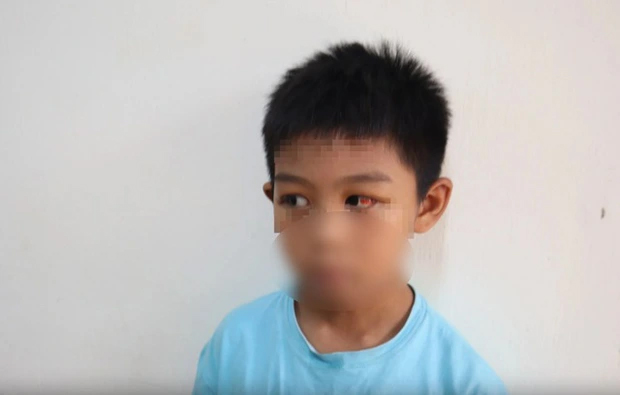 Vụ cha dượng đánh con riêng của vợ cũ: Người mẹ phản ứng thế nào khi con bị đánh?-1